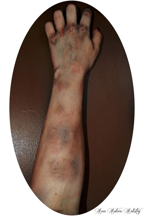 shadows breathe sfx bruises