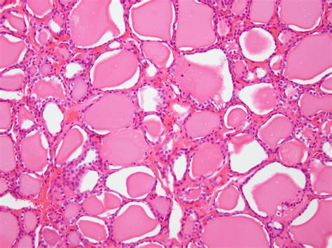 Histology-Thyroid-Gland - Jeffrey Dach MD