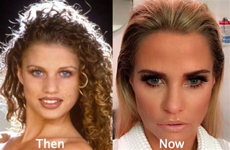 Katie Price Before and after - Latest Plastic Surgery Gossip And News ...