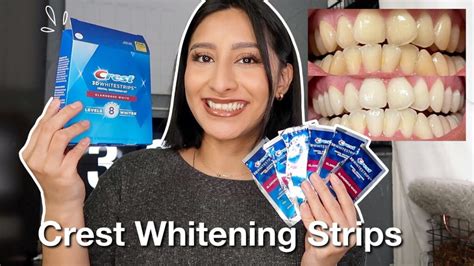 I TRIED THE CREST 3D WHITESTRIPS FOR 14 DAYS *Effective* | Before & After Pictures - CCETA