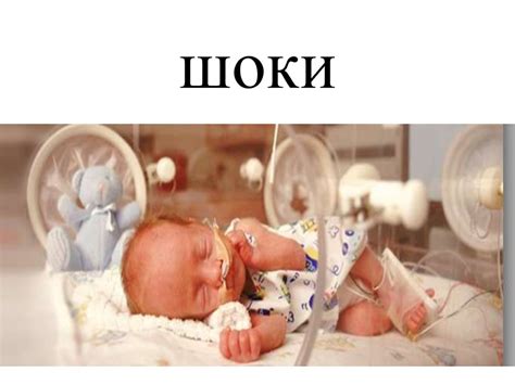 Шоки - презентация онлайн