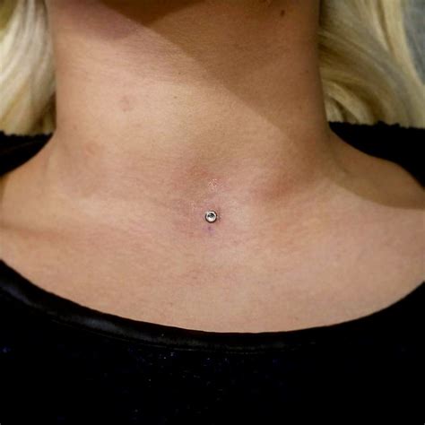 Flickriver: Most interesting photos tagged with microdermals