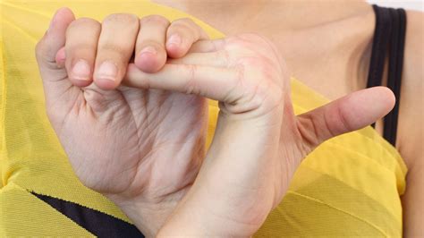 What Are Ehlers-Danlos Syndromes, and Is There Treatment? - GoodRx