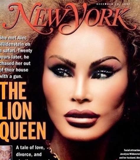 Did Jocelyn Wildenstein's Transformation Go Too Far? Experts Weigh In Image 14