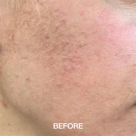 PRX-T33 | Skin dreams come true | The perfect skin-care 2023