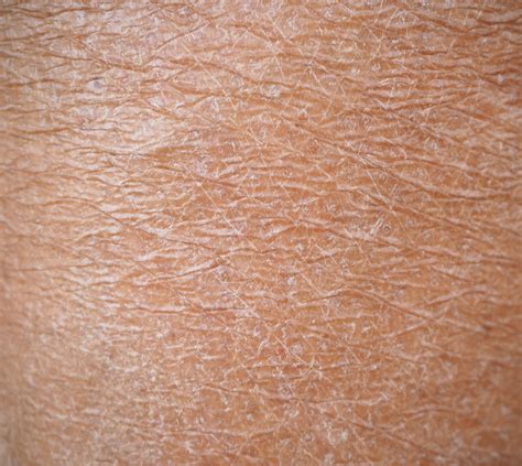 Dry vs Dehydrated Skin – Nimue