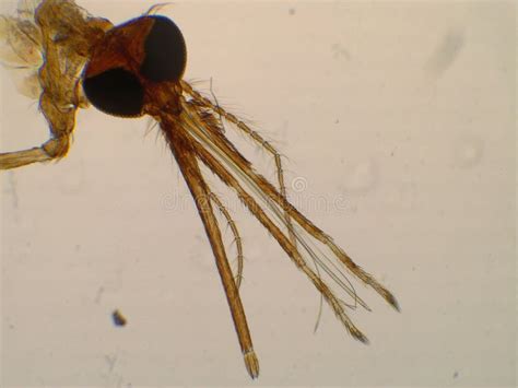 Anguaiole Da Morso Di Ananas Sotto Microscopio Vettore Dell'agente ...