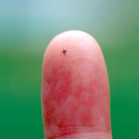 Here's Why There Are So Many Ticks This Summer, Say Experts | The
