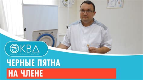 Черные пятна на члене. Клинический случай №66 - YouTube
