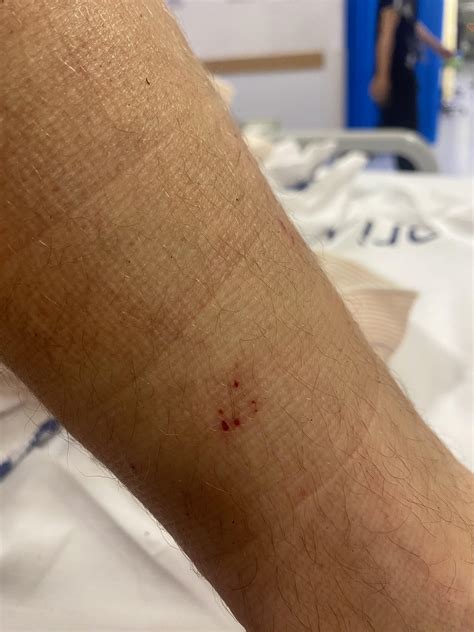 423 best Brown Snake images on Pholder | Whatsthissnake, Brisbane and