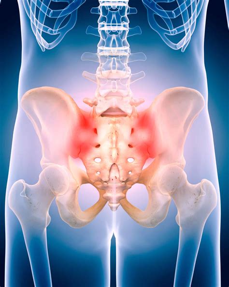 Sacroiliac Joint Dysfunction - Jing Advanced Massage Training