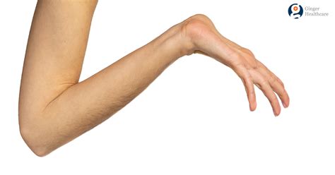 Marfan Syndrome Family