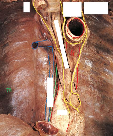 Posterior Mediastinum (Cadaver) Diagram | Quizlet