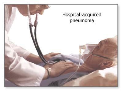 Nosocomial pneumonia definition, risk factors, diagnosis & treatment