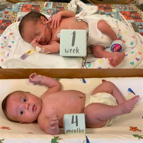 Baby Born At 30 Weeks