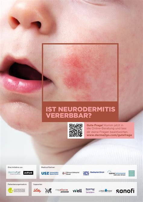 Andfrank schafft Awareness für atopische Dermatitis - Werbewoche m&k