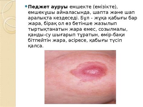 Тері физиологиясы