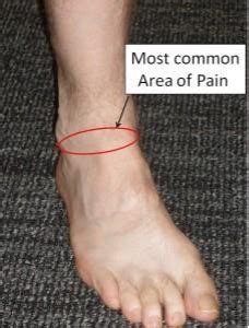 Anterior Ankle conditions ( front ankle) | Cheltenham Podiatry