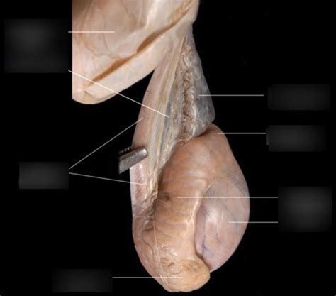 The scrotum Diagram | Quizlet