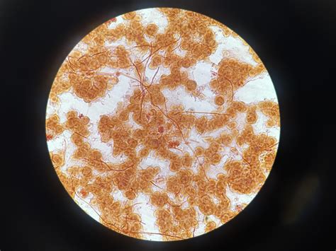 Enterobacter cloacae complex blood culture. Pt has been treated with