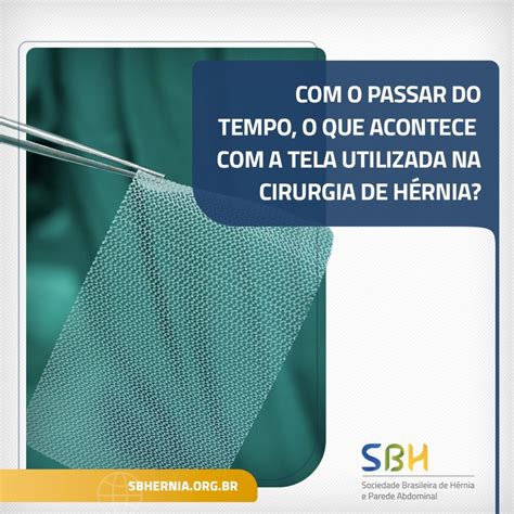 A Tela Da Hérnia Pode Sair Do Lugar