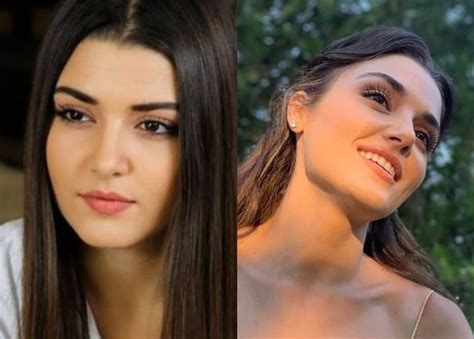 До и после: пластическая хирургия Ханде Эрчел