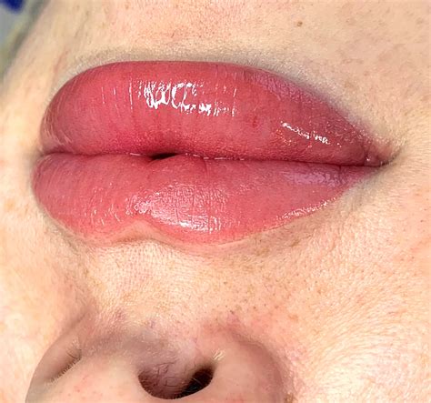 Is Lip Blush Safe with Cold Sores?