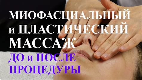 Остеопатический и пластический массаж. Лицо до и после процедуры ...