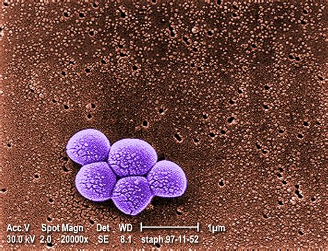 foto gratis raggruppamento meticillina resistente staphylococcus