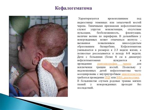 Родовые травмы новороженных - презентация онлайн