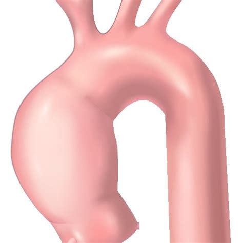 techniques  unilateral  bilateral antegrade cerebral