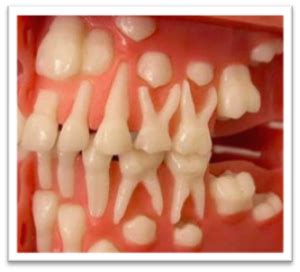 babys  teeth  lives healthy futures