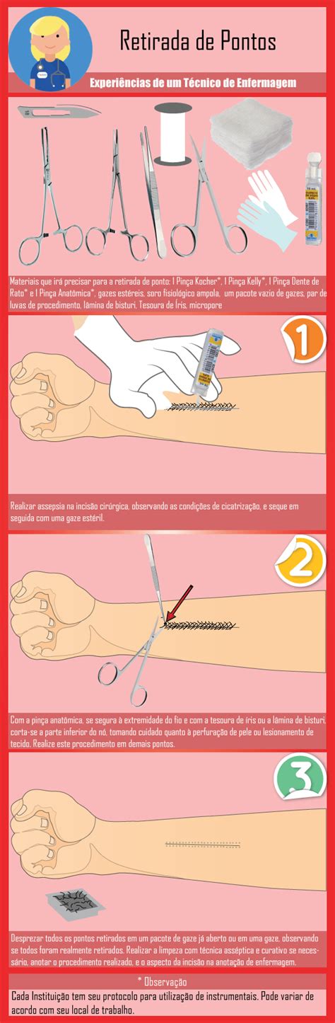 O Que É Bom Para Cicatrização De Pontos - Retirada de Pontos - Enfermagem Ilustrada
