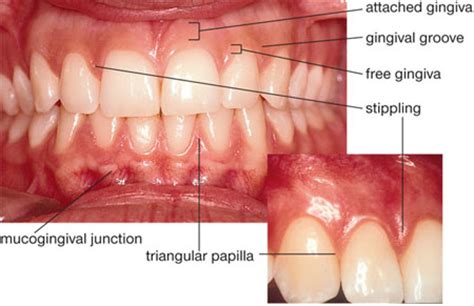 Marginal Gingiva