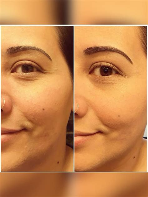 Era organics – Artofit