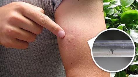 Características del zancudo del dengue