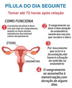 Quanto Tempo A Pilula Do Dia Seguinte Atrasa A Menstruação