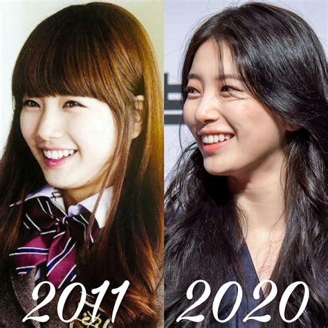 Suzy Plastic Surgery