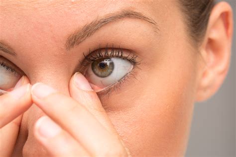 Things to Know About a Stye: Causes and Treatments – ActiveBeat – Your