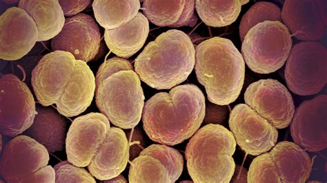 Gonorrhea Zinc Sulfate Treatment at Sandra Downs blog