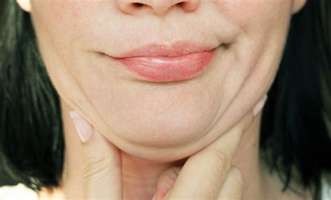 how to know if you need jaw surgery