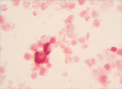 microbiology lablogatory