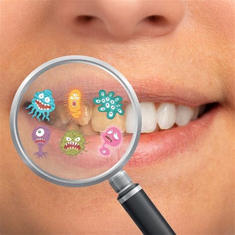 Oral Biotic – Oral Probiotics for Mouth I Sensilab