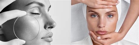 REVIDERM
