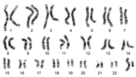 chromosomal inheritance