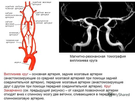 Презентация на тему: "1. твердая (dura mater) 2. паутинная (arachnoidea ...