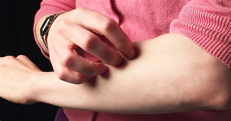 Червени петна по кожата: причини за появата, видове и лечение • lekuva.net