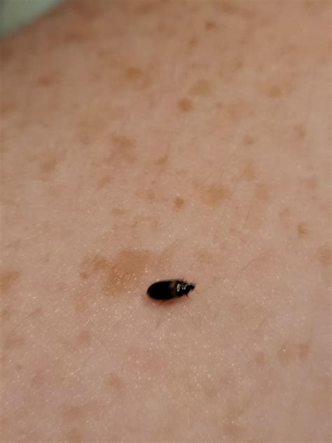 What is this tiny black bug in British Columbia, Canada? : r/whatsthisbug