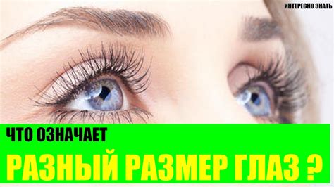 Что означают глаза разного размера? - YouTube