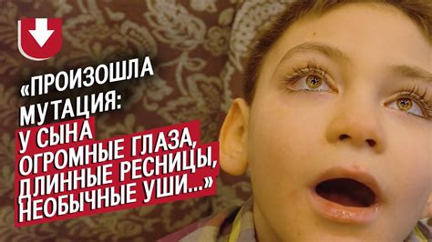 У моего сына синдром Кабуки: Лилия | Быть мамой - YouTube
